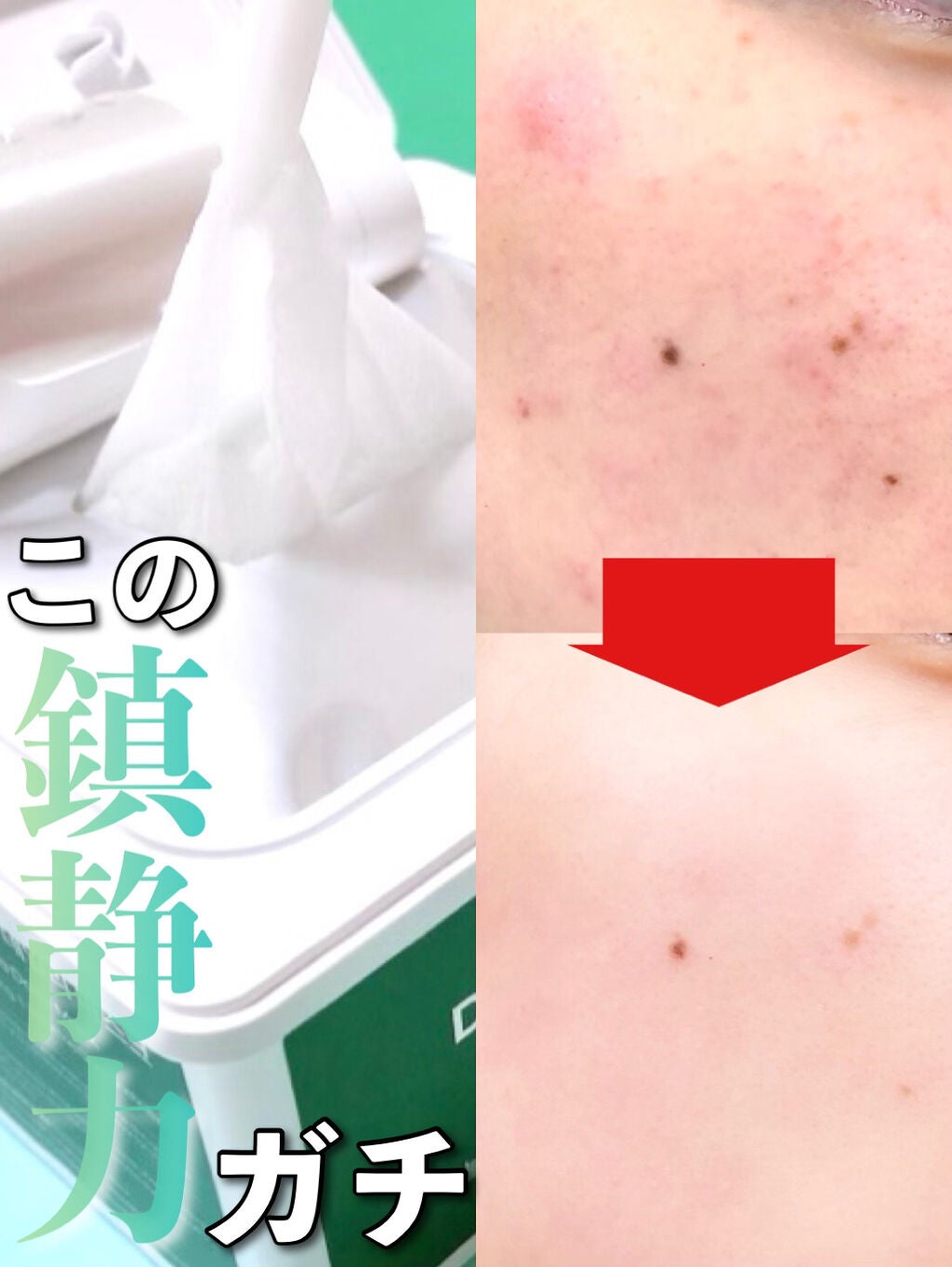 ダーマエクトシカデイリーマスク/Neulii/シートマスク・パックを使ったクチコミ(1枚目)