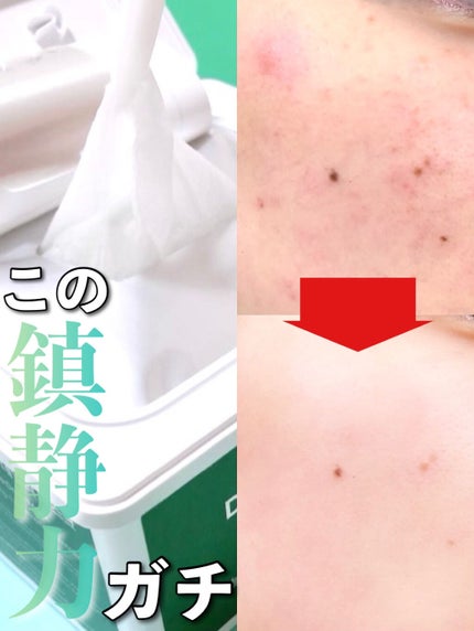 Neulii ダーマエクトシカデイリーマスクのクチコミ「メガ割なら1,400円で買える!個人的にVTより使いやすい鎮静力に信頼しかない大容量マスク
.....」(1枚目)