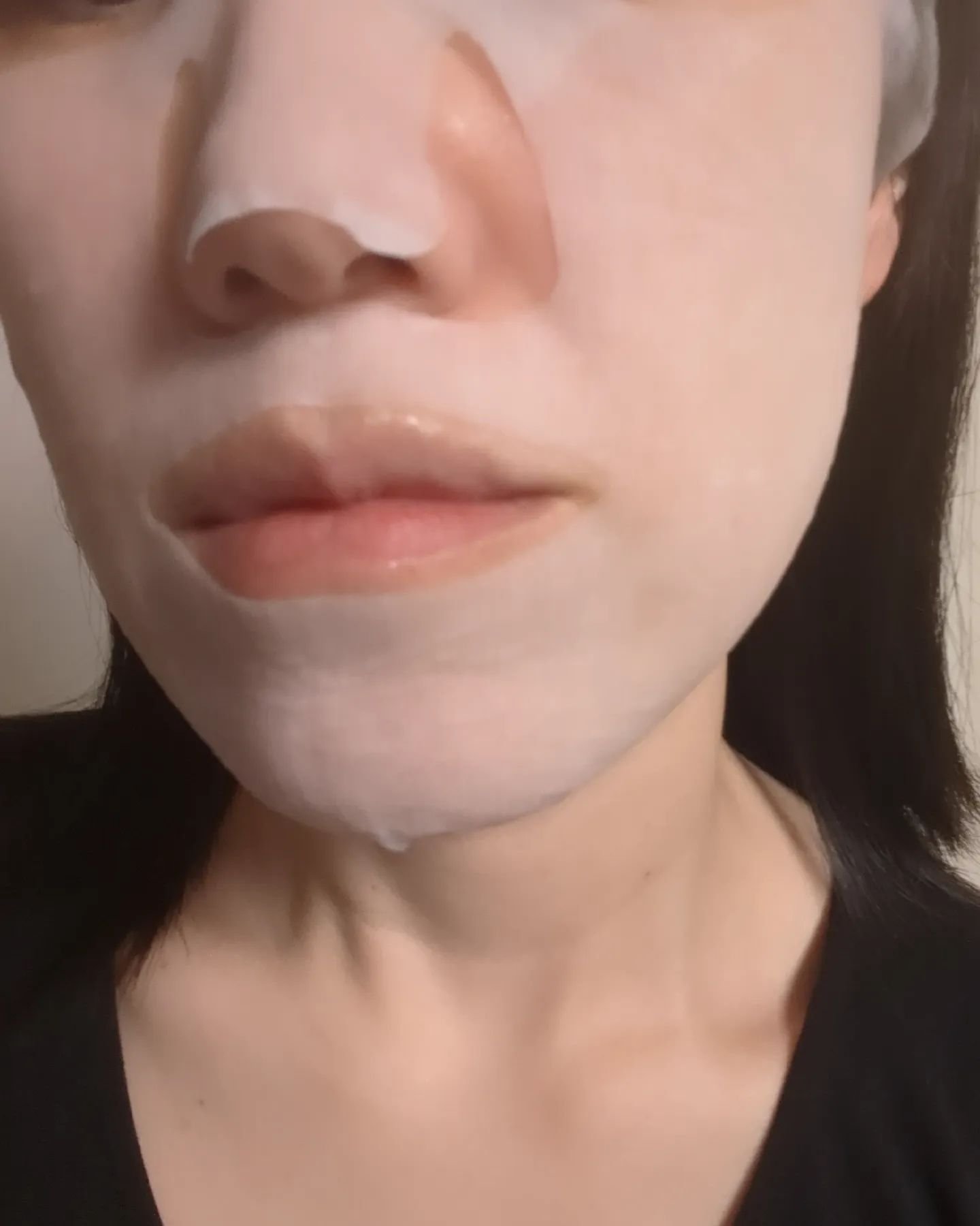 薬用ルルルン 美白アクネ/ルルルン/シートマスク・パックを使ったクチコミ（2枚目）