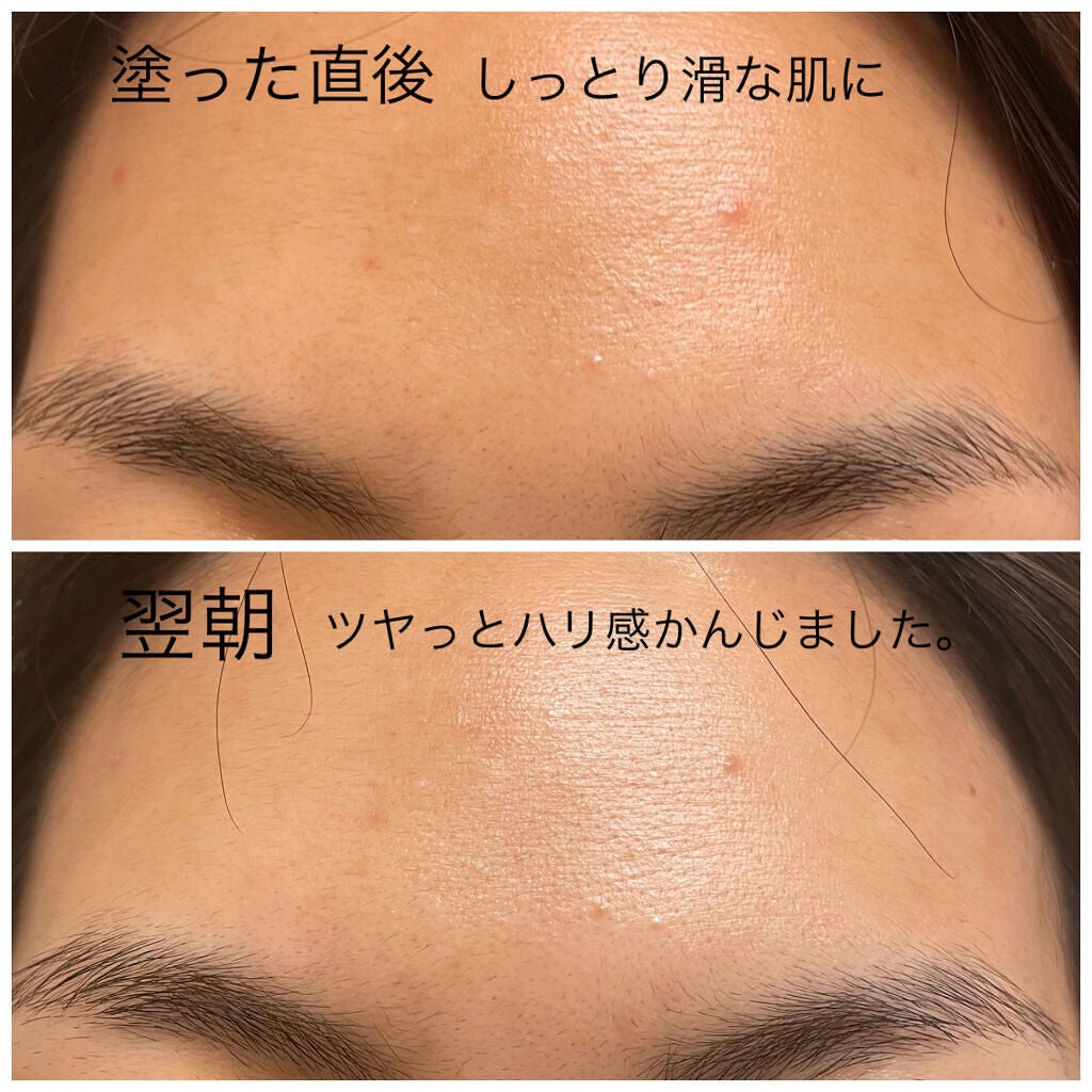 ベラコントゥアーフォーミングクリーム/ANACIS/フェイスクリームを使ったクチコミ(7枚目)