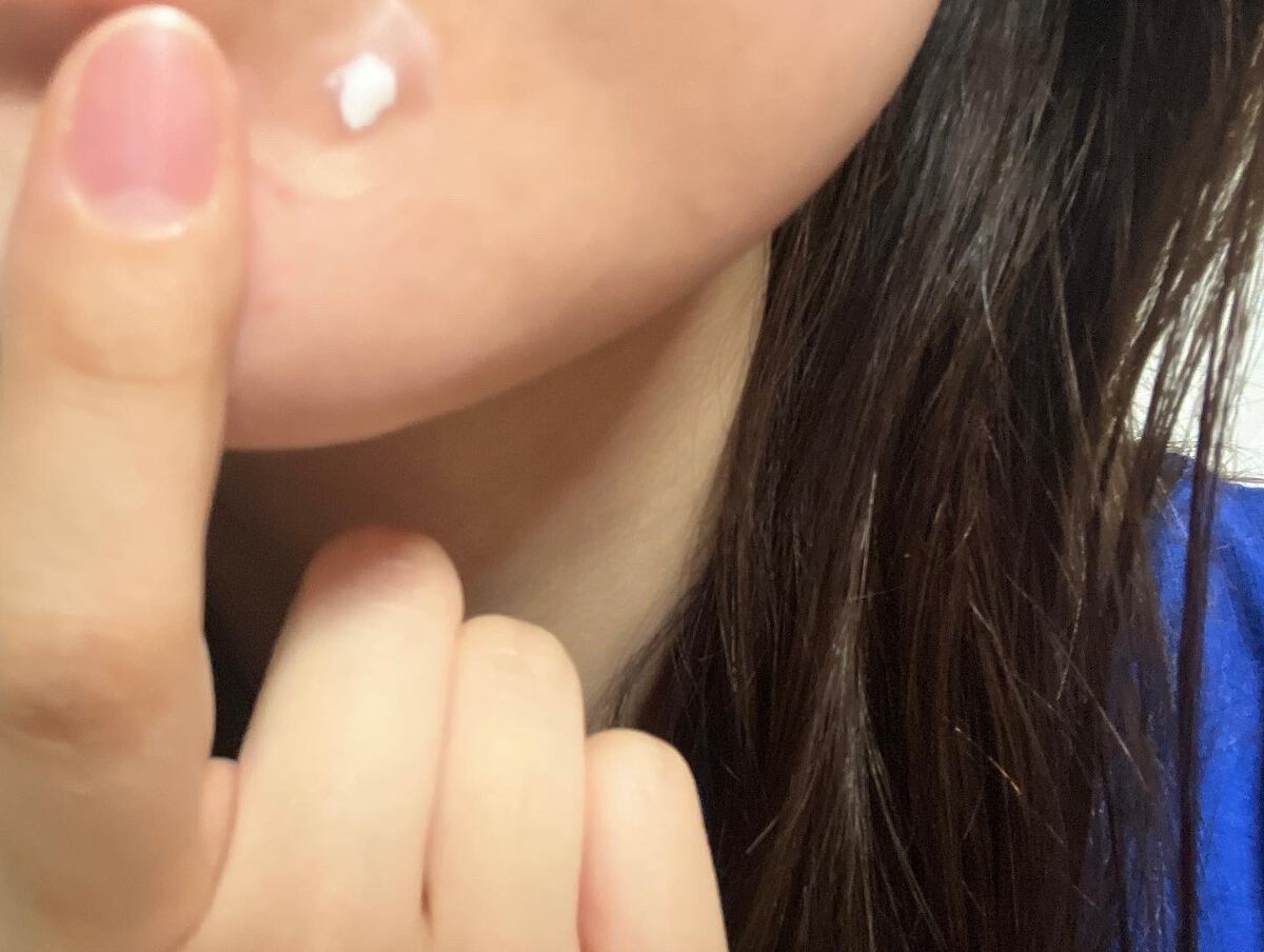 薬用ニキビケア スポッツクリーム/アクネスラボ/フェイスクリームを使ったクチコミ（3枚目）