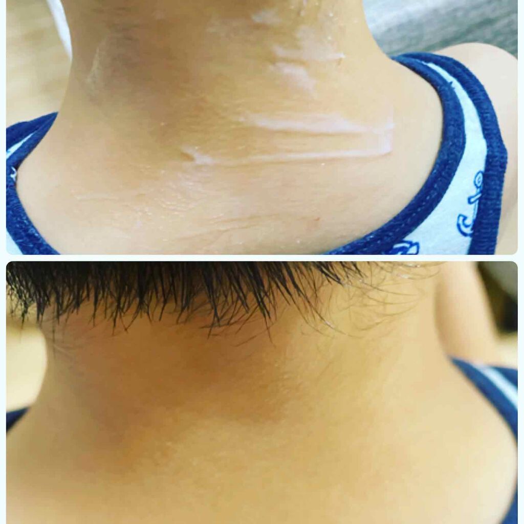 薬用保湿ミルクジェル/MEDIBABY/乳液を使ったクチコミ（3枚目）