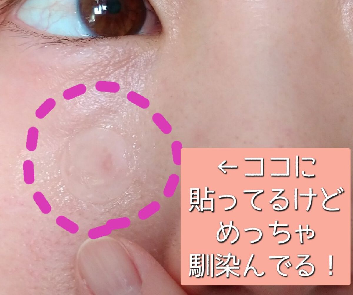 プロCICA クリアスポットパッチ/VT/その他スキンケアを使ったクチコミ（2枚目）