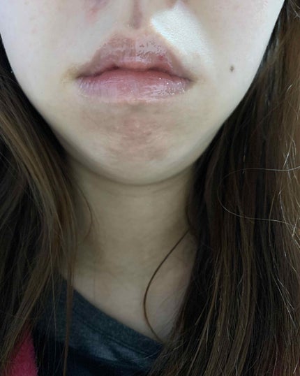 ピゥ ぷるぷるリップN/piu/リップケアを使ったクチコミ(3枚目)