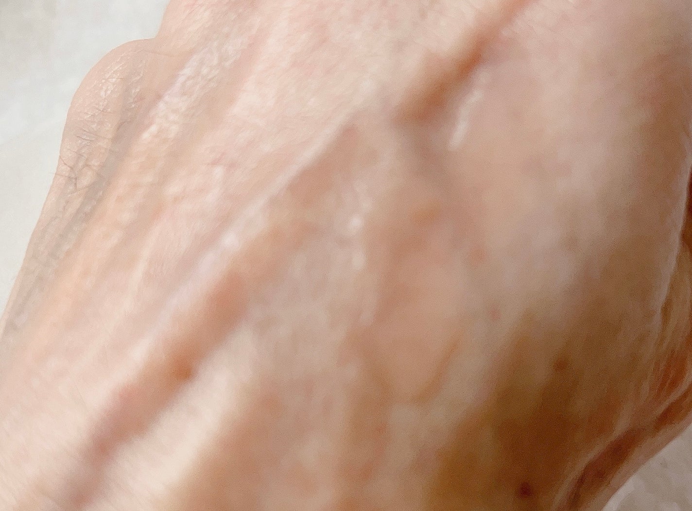 ピンクティーツリートナー/APLIN/化粧水を使ったクチコミ(3枚目)