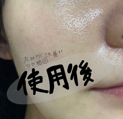 ザビタミンC23/IOPE/美容液を使ったクチコミ(4枚目)