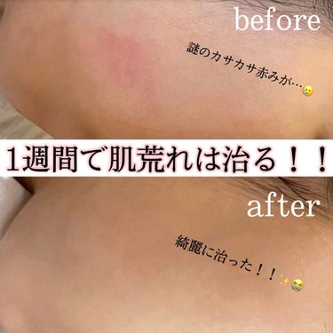 乳液・敏感肌用・高保湿タイプ/無印良品/乳液を使ったクチコミ（1枚目）