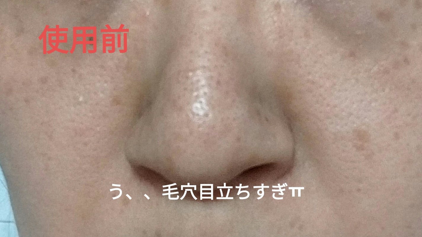 角質スッキリ毛穴パック /HANYUL(ハンユル)/洗い流すパック・マスクを使ったクチコミ(2枚目)