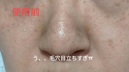 角質スッキリ毛穴パック /HANYUL(ハンユル)/洗い流すパック・マスクを使ったクチコミ(2枚目)