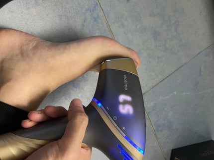 アイスダンディ/notime/家庭用脱毛器を使ったクチコミ(1枚目)