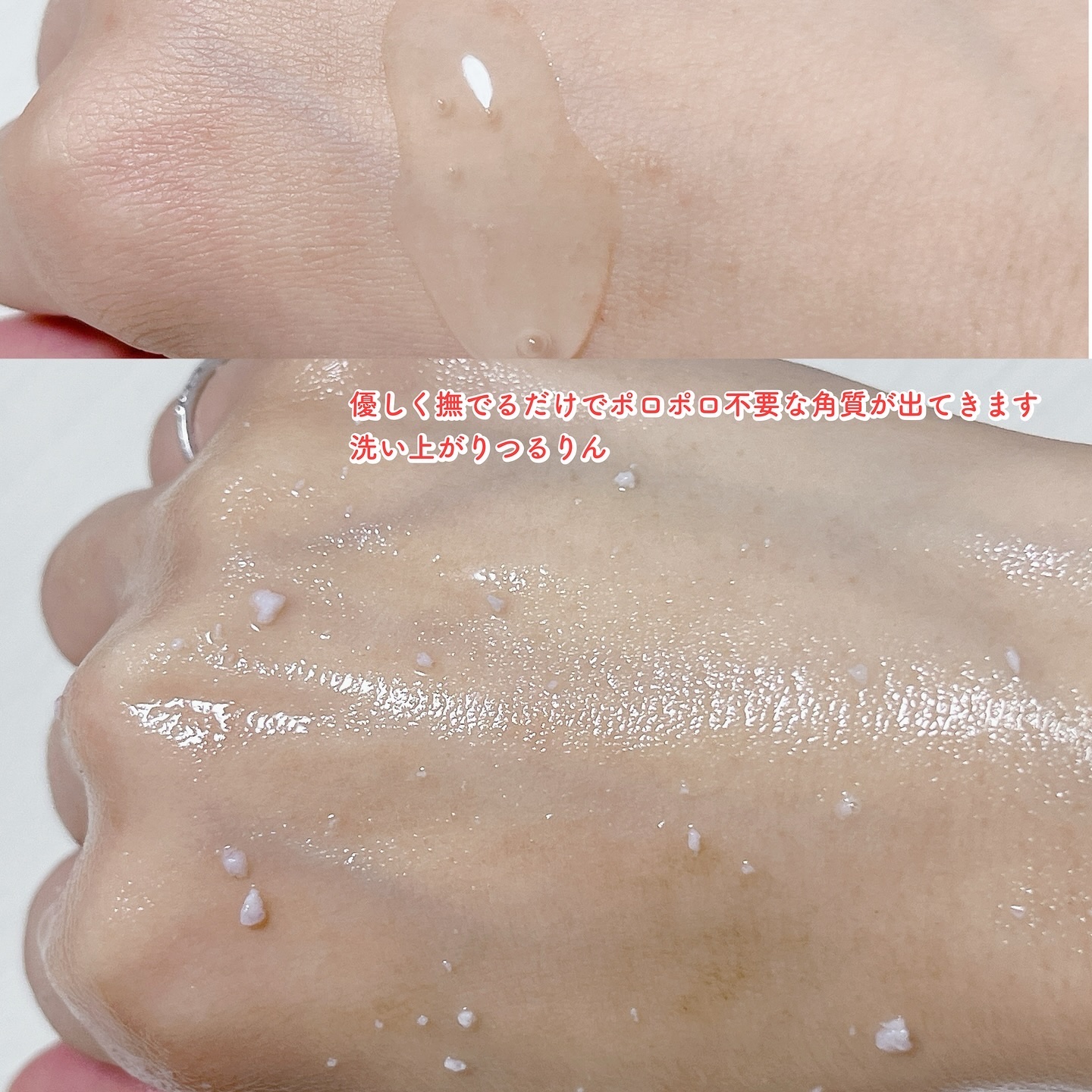 DETクリア ブライト&ピール ピーリングジェリー〈エイジングケアタイプ〉/Detclear/ピーリングを使ったクチコミ（3枚目）