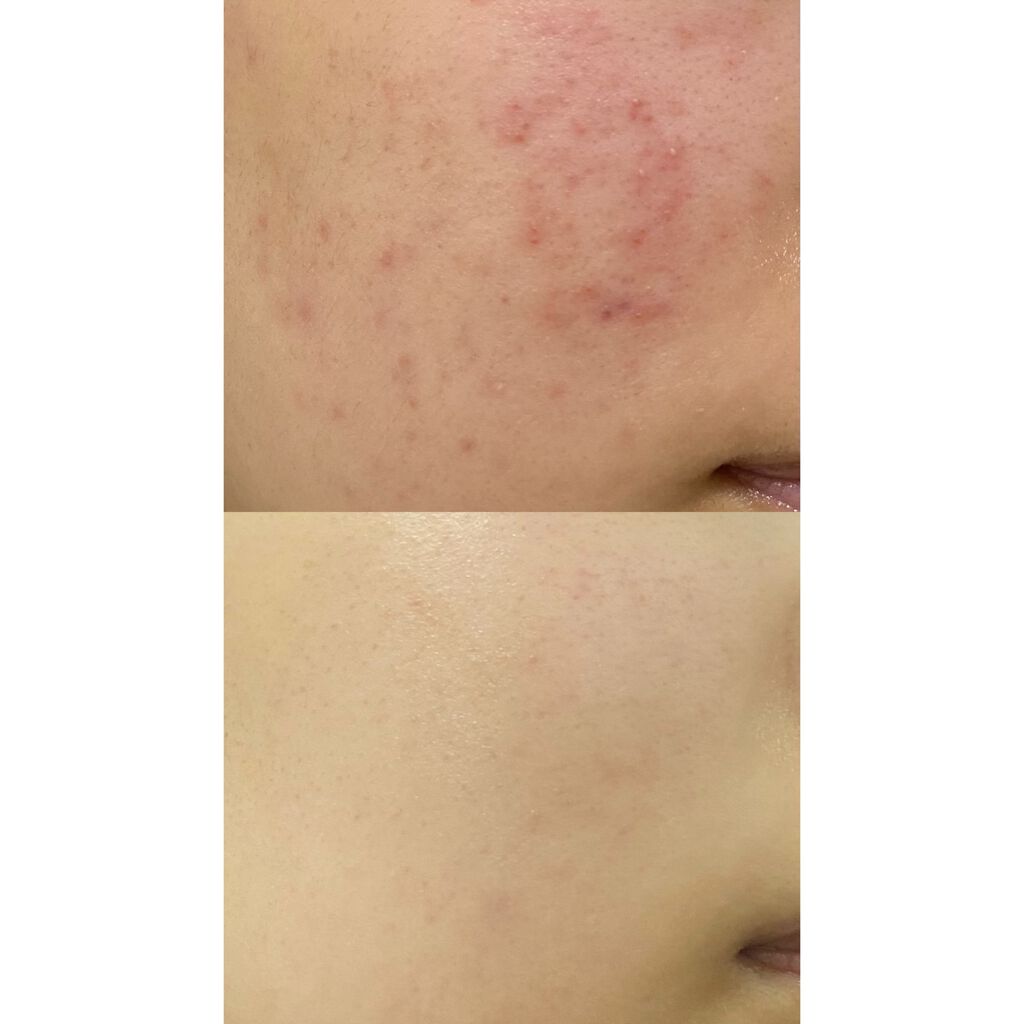 みぃ フォロバいいね返し100 on LIPS 「1枚目からお見苦しい写真で申し訳ありません🥲今回は私が水を飲み..」(2枚目)