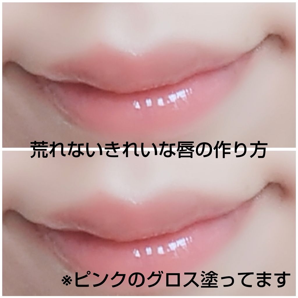 薬用リップクリーム Dhcを使った口コミ 荒れないきれいな唇の作り方 ーーーーー By のあ Lips