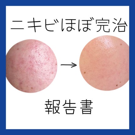 薬用ローション(しっとり)/IHADA/化粧水を使ったクチコミ(1枚目)
