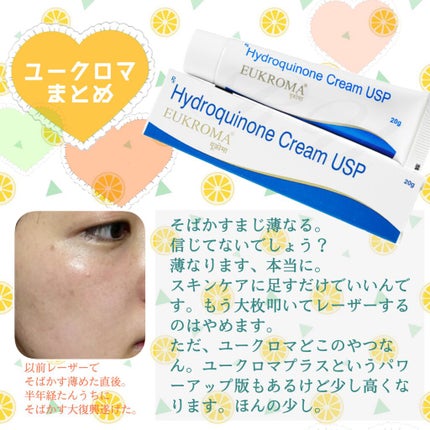 EUKROMA ハイドロキノンクリーム4% 20g/EUKROMA/その他スキンケアを使ったクチコミ(5枚目)