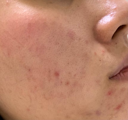 を使ったクチコミ(2枚目)