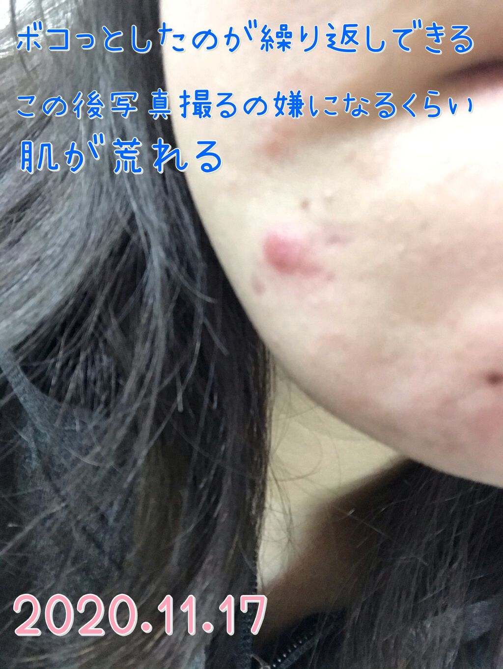 ハトムギ化粧水(ナチュリエ スキンコンディショナー R )/ナチュリエ/化粧水を使ったクチコミ（2枚目）