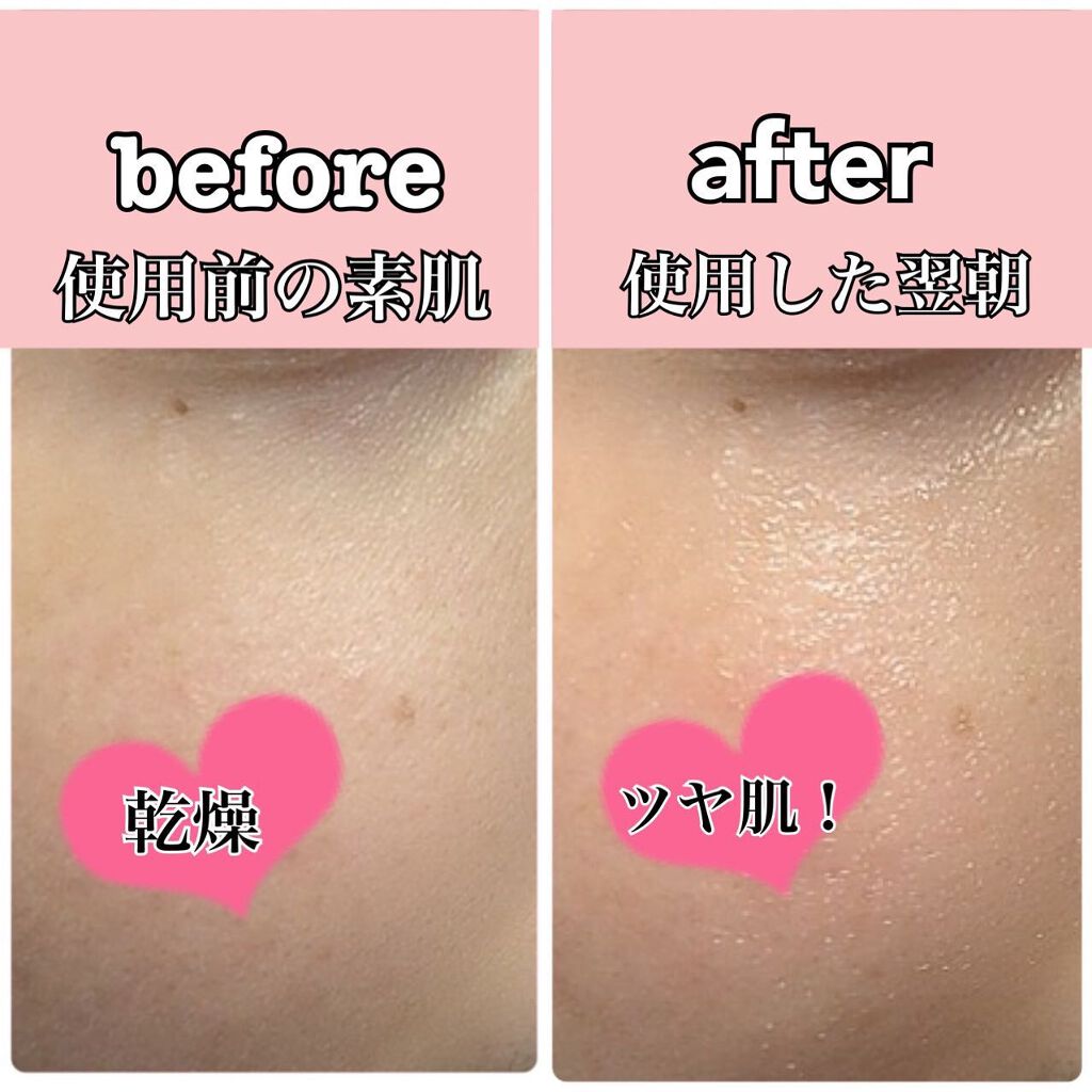 ビューティーオープナージェル リンクル&ホワイト/オージオ/美容液を使ったクチコミ(7枚目)