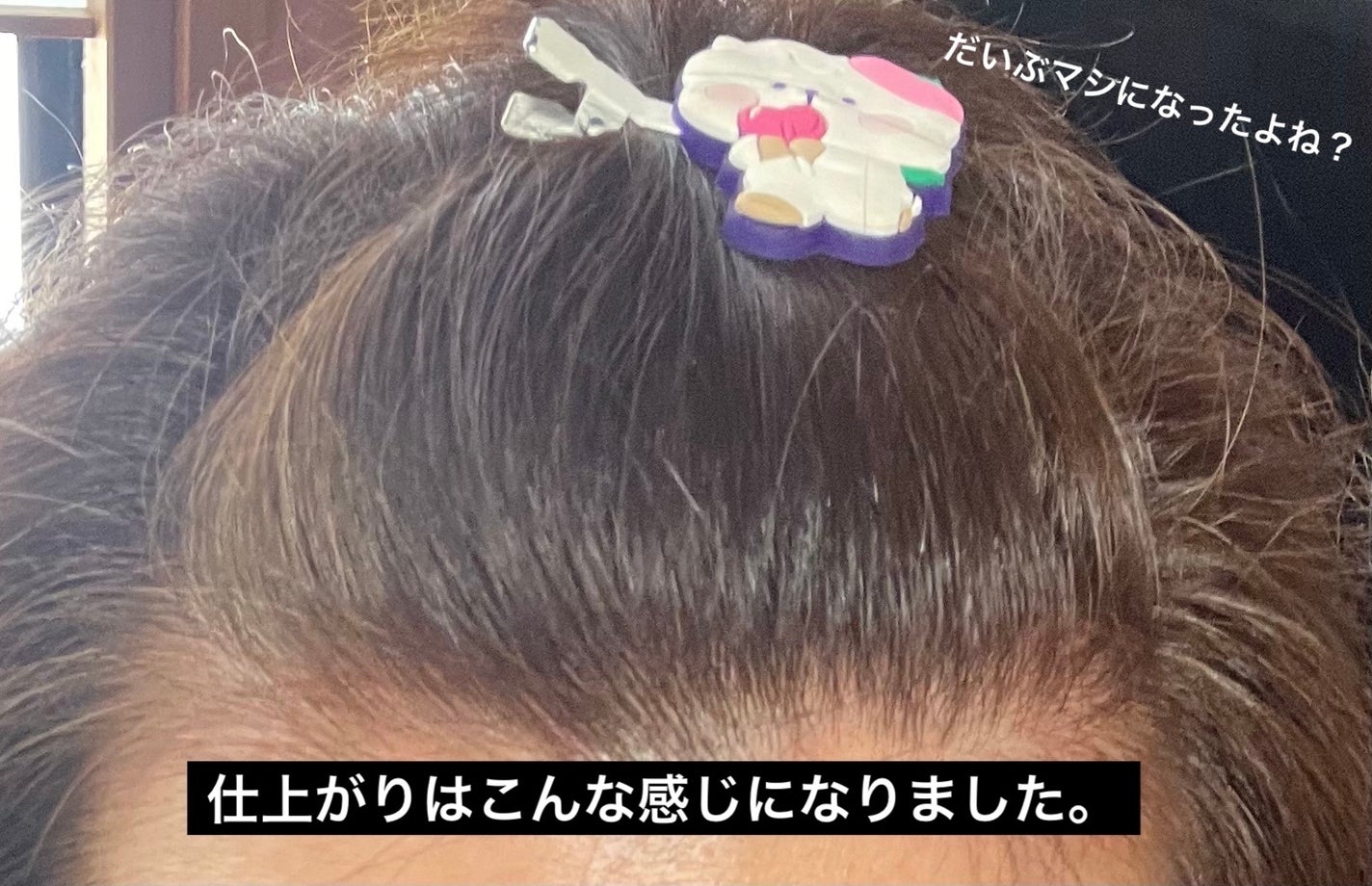 ムースカラー/CIELO/ヘアカラーを使ったクチコミ(5枚目)