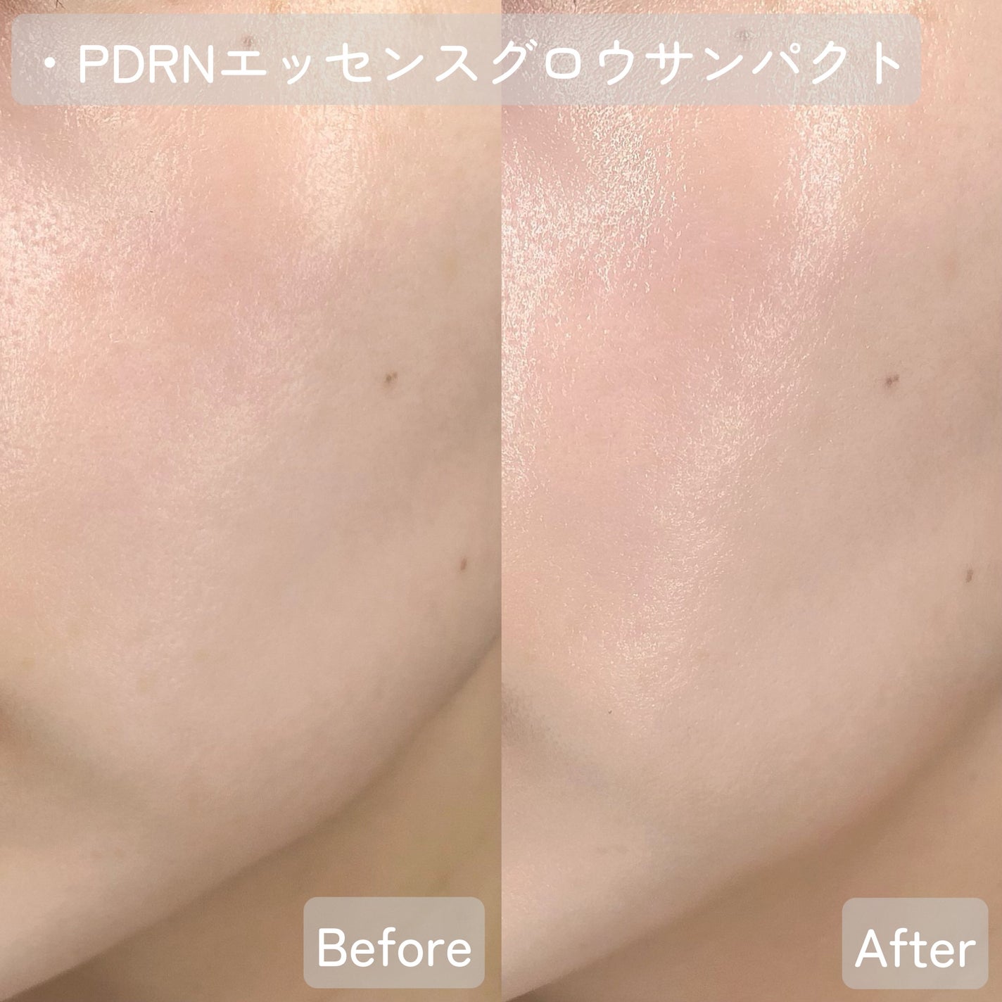 ピーディーアールエヌエッセンス PDRN 100/VT/美容液を使ったクチコミ(6枚目)