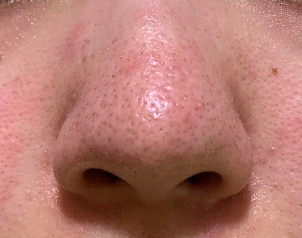 アミノ酸浸透ジェル/Mマークシリーズ/フェイスクリームを使ったクチコミ(4枚目)