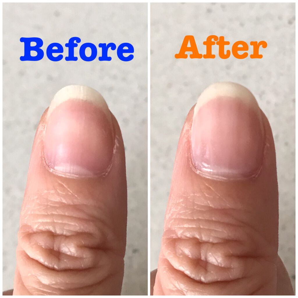 ネールガード/ettusais/ネイルトップコートを使ったクチコミ（2枚目）