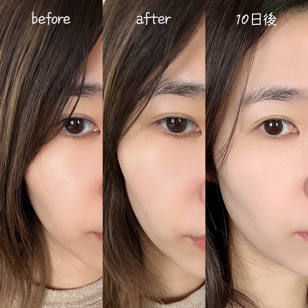 ビタミンB9トーンアップクリーム/NATURAL DERMA PROJECT/化粧下地を使ったクチコミ（3枚目）