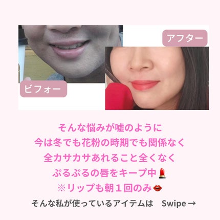 美肌カウンセラー💆肌悩みを解決し見る世界を変える on LIPS 「口唇のカサカサ、何を使っても唇が荒れる、リップが手放せない…そ..」(4枚目)