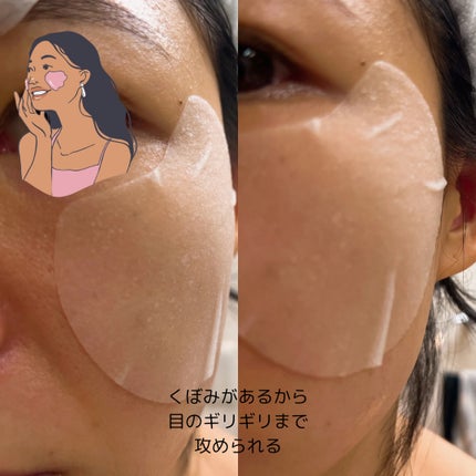 センテラ クイックカーミングパッド/SKIN1004/トナーパッドを使ったクチコミ(7枚目)