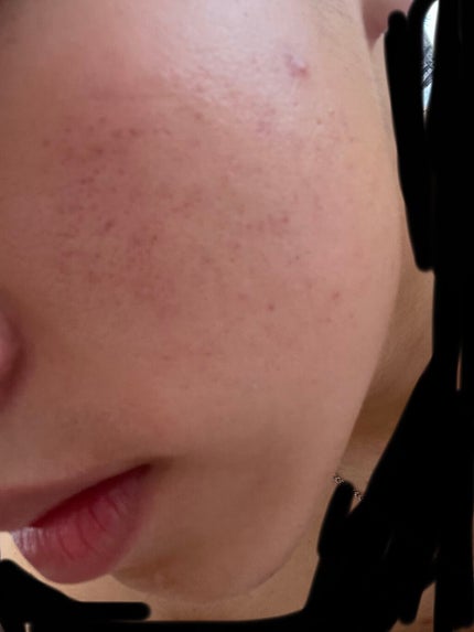 フレッシュリージュースドビタミンドロップ(35ml)/Klairs/美容液を使ったクチコミ(1枚目)