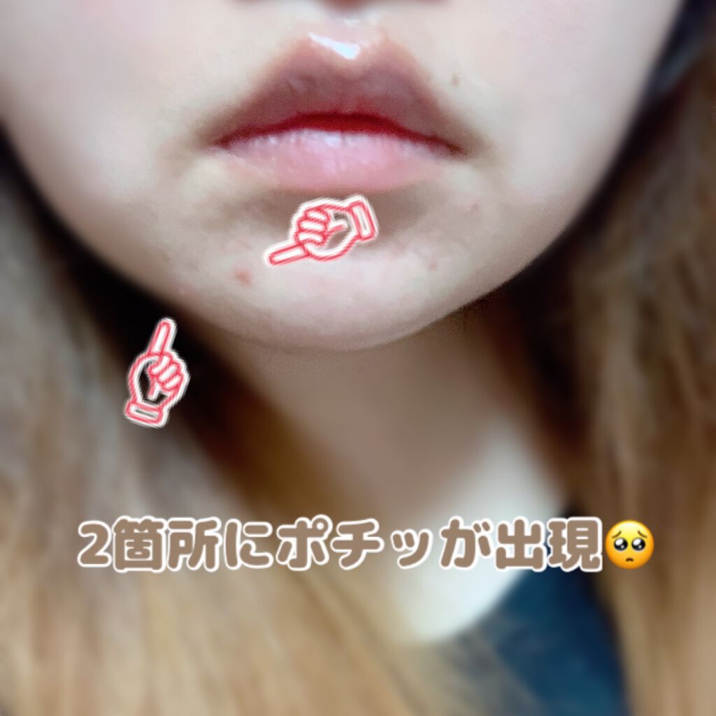 プロCICA クリアスポットパッチ/VT/その他スキンケアを使ったクチコミ（2枚目）