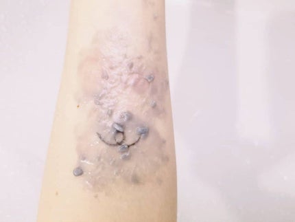 チャコールクレンズ/ECLAS/クレンジングバームを使ったクチコミ(7枚目)