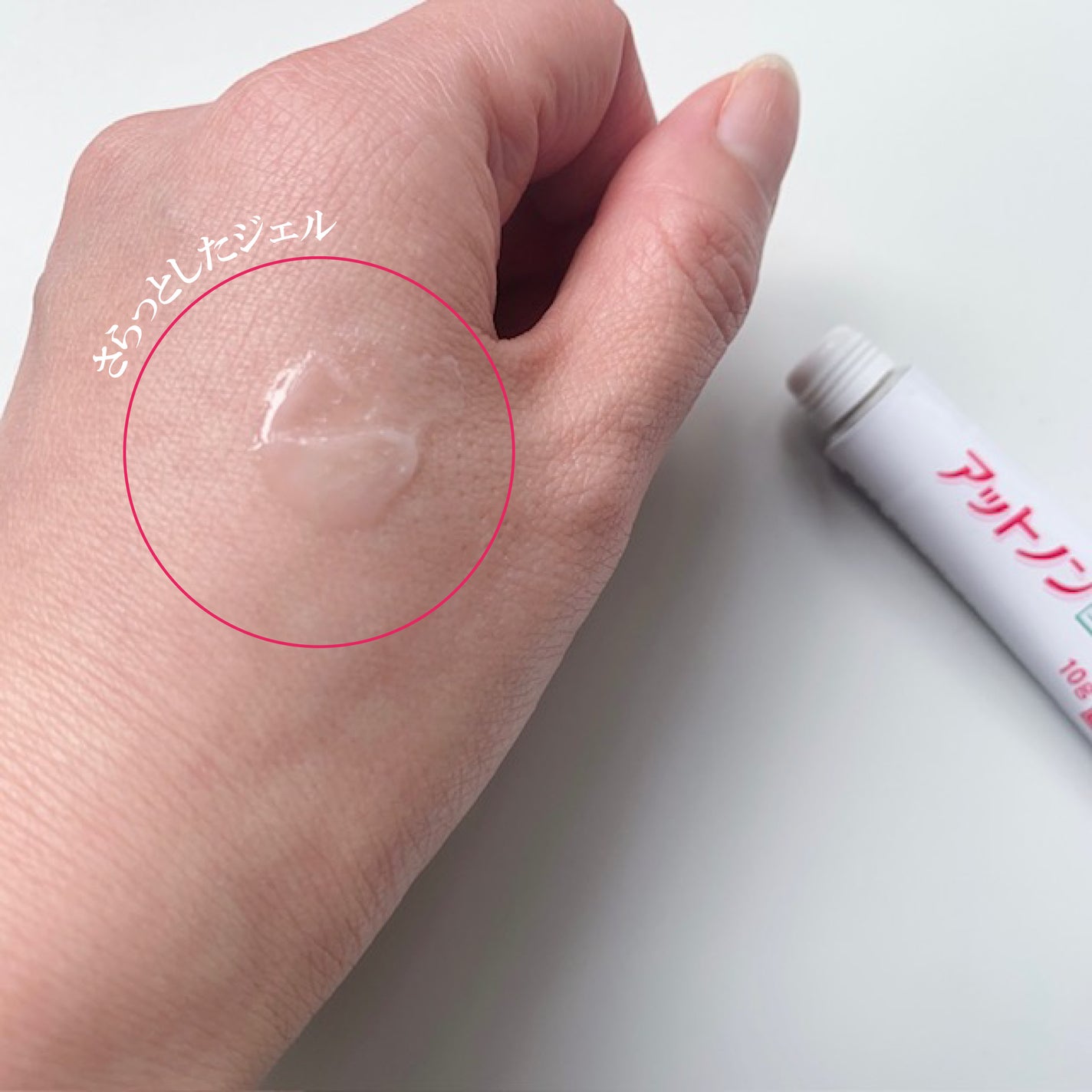 ニキビあとケアジェル/アットノン/その他スキンケアを使ったクチコミ(2枚目)