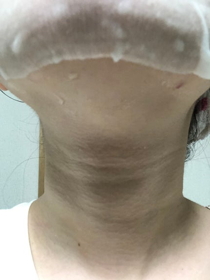 ルルルンプレシャス WHITE(クリア)【旧】/ルルルン/シートマスク・パックを使ったクチコミ(5枚目)