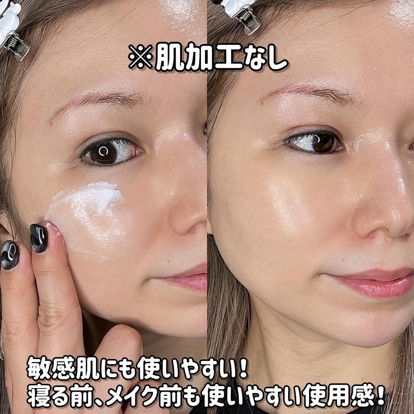 アトバリア365クリーム/AESTURA/フェイスクリームを使ったクチコミ(5枚目)