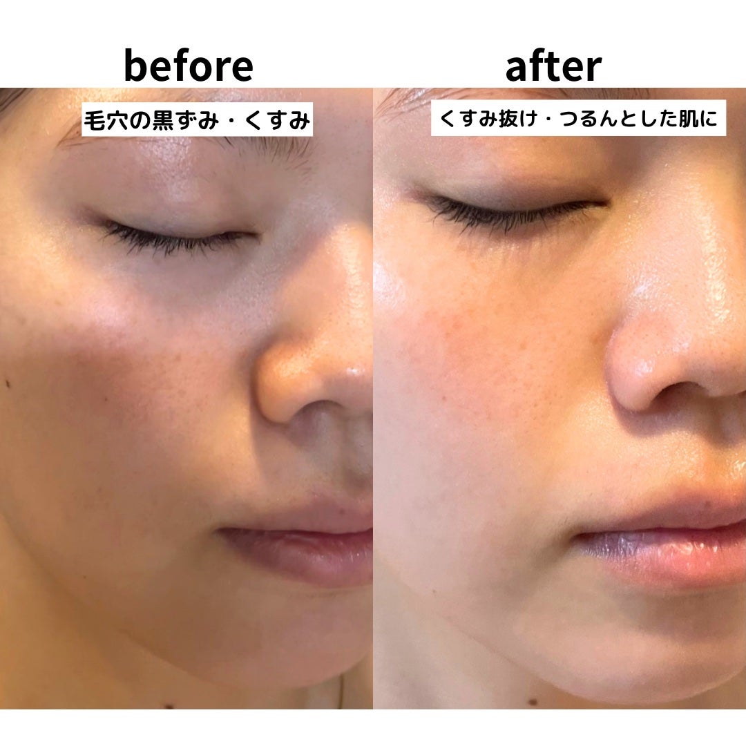 ビタC グリーンティーエンザイム ブライト セラム/innisfree/美容液を使ったクチコミ(3枚目)