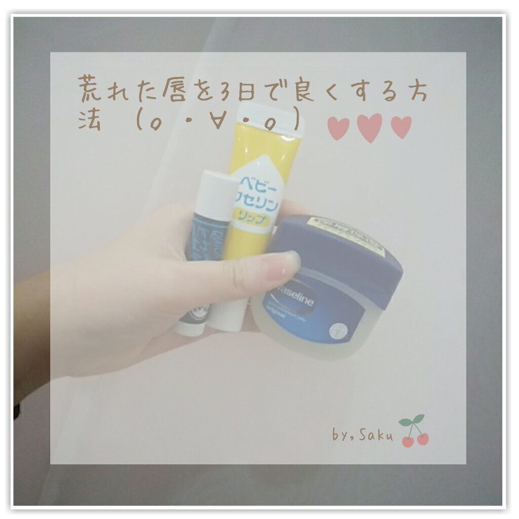 薬用リップＮＪ(薬用リップナチュラル)/メンソレータム/リップクリームを使ったクチコミ（1枚目）