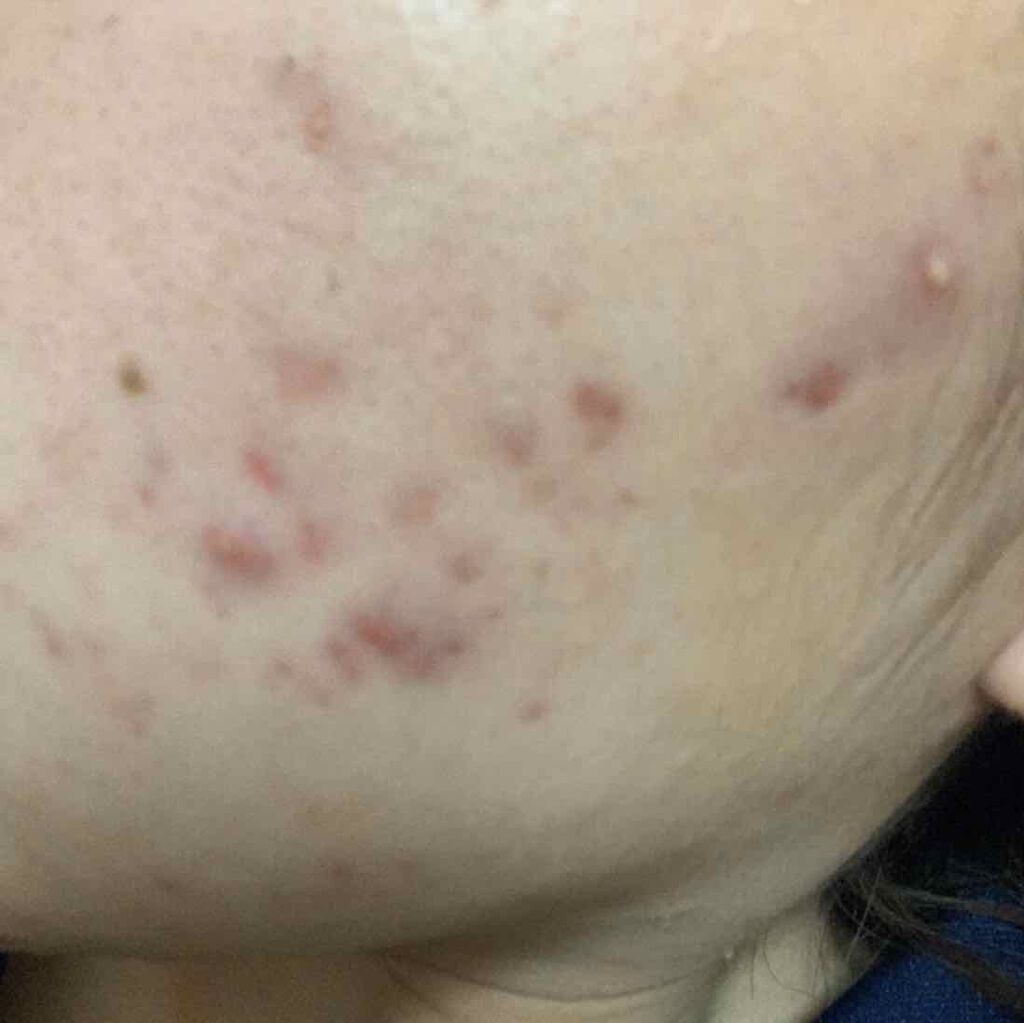 薬用しみ対策 美白化粧水/メラノCC/化粧水を使ったクチコミ（2枚目）