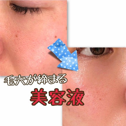 Caffeine Solution 5% + EGCG/The Ordinary/美容液を使ったクチコミ(1枚目)