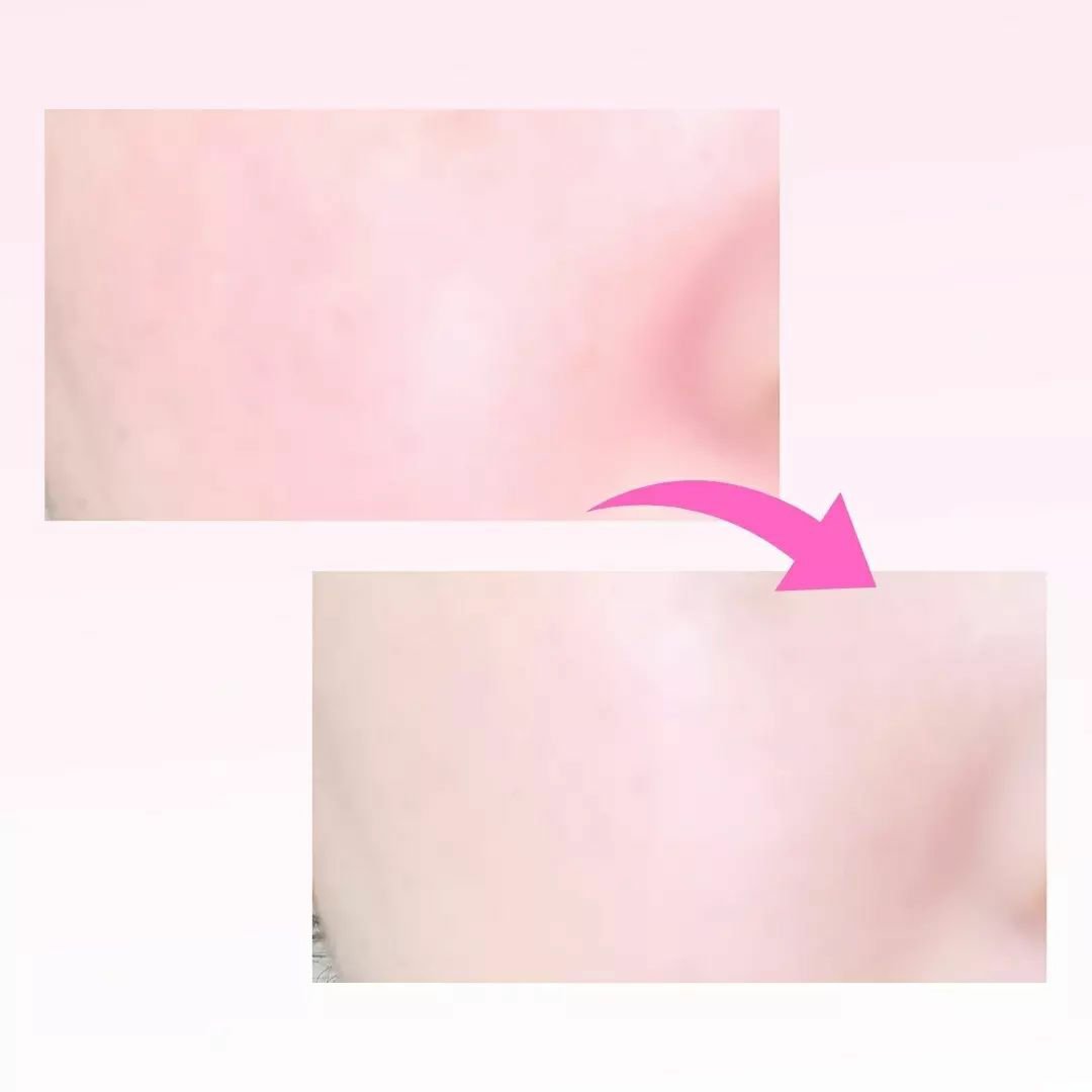 薬用クリアエステヴェールEX/Macchia Label/リキッドファンデーションを使ったクチコミ（3枚目）