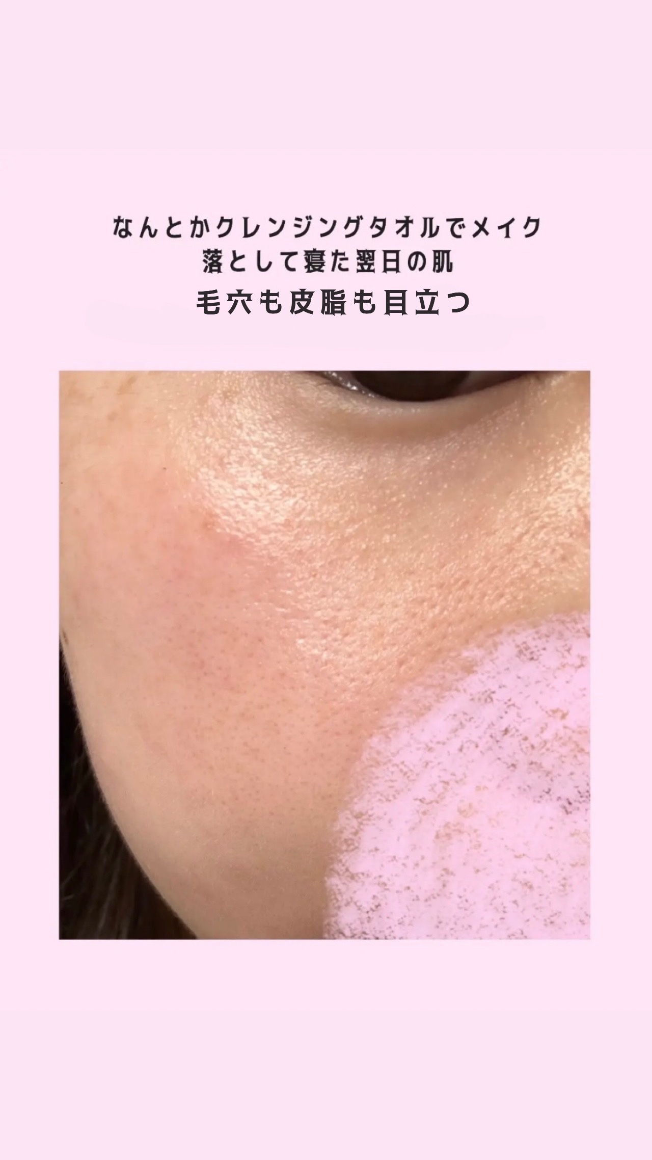 ルルルンプレシャス GREEN(バランス)【旧】/ルルルン/シートマスク・パックを使ったクチコミ（3枚目）