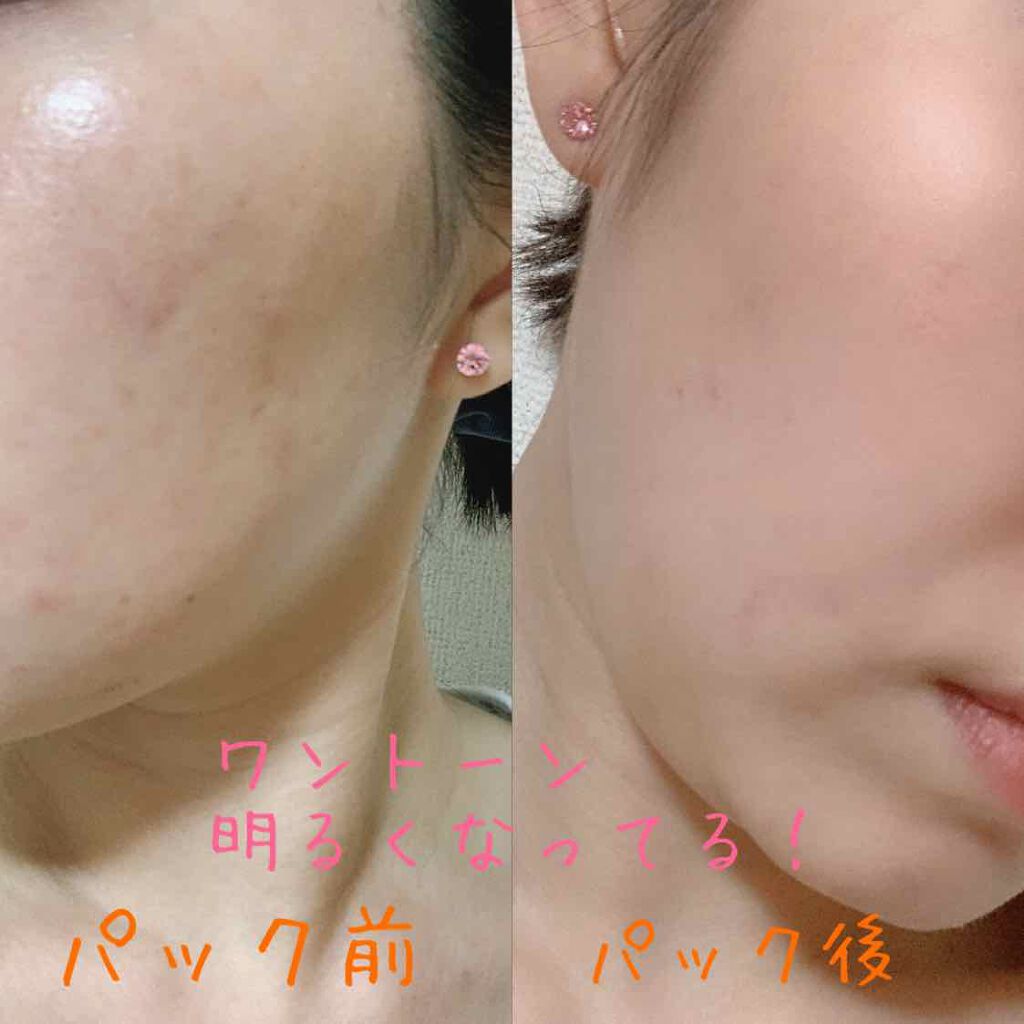 SAYAð裞çŒã¢ã€ã¡ã€ã¯ on LIPS ããã¹æ¥æ¬ãçµ¶è³çé
žããã¯â£ïžï»¿ãŠãã¯ã·ã¢çé
žããã¯ãã«ãªðð..ãïŒ3æç®ïŒ