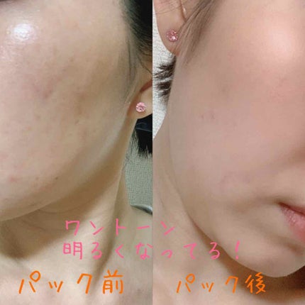 を使ったクチコミ(3枚目)