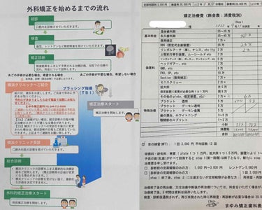 マウスピース矯正/その他を使ったクチコミ（2枚目）