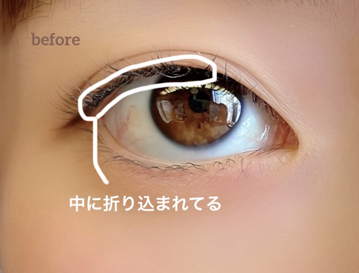 のびーるアイテープ（絆創膏タイプ、レギュラー）/DAISO/二重まぶた用アイテムを使ったクチコミ（2枚目）