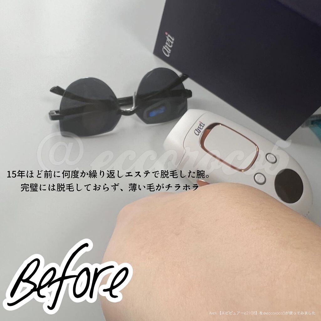 エピピュアーe2108/Areti./ボディケア美容家電を使ったクチコミ（2枚目）