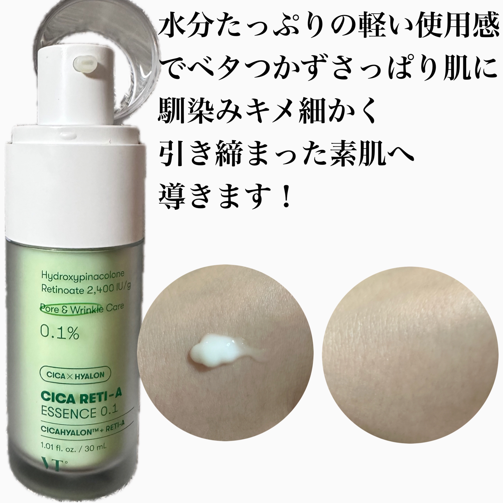 シカレチA エッセンス0.1/VT/美容液を使ったクチコミ（2枚目）