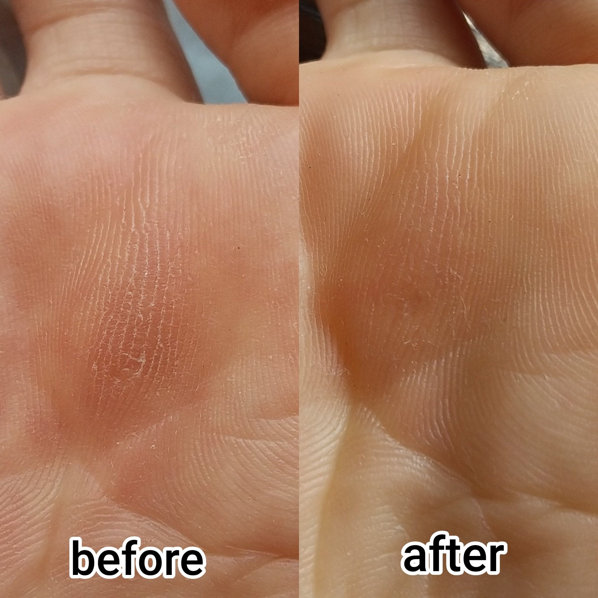 Rooroピンポイント角質やすり/Rooro/その他を使ったクチコミ（2枚目）