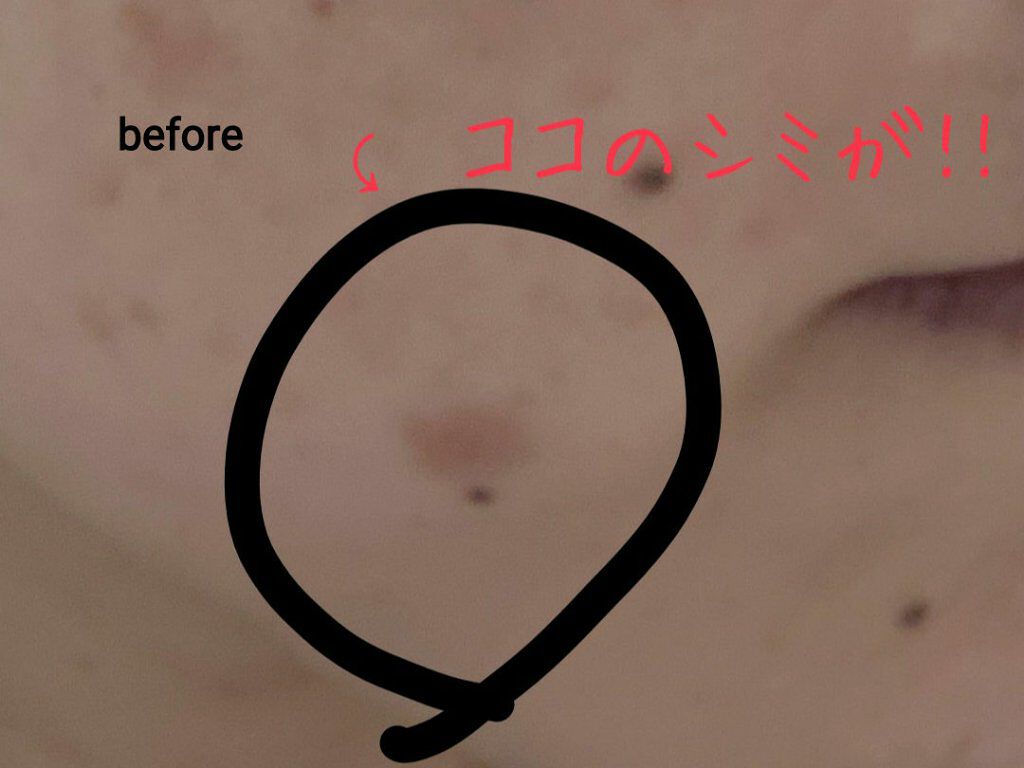 ろおす on LIPS 「こんにちは(•ө•)♡商品のご説明ではないですが、シミが気にな..」(2枚目)