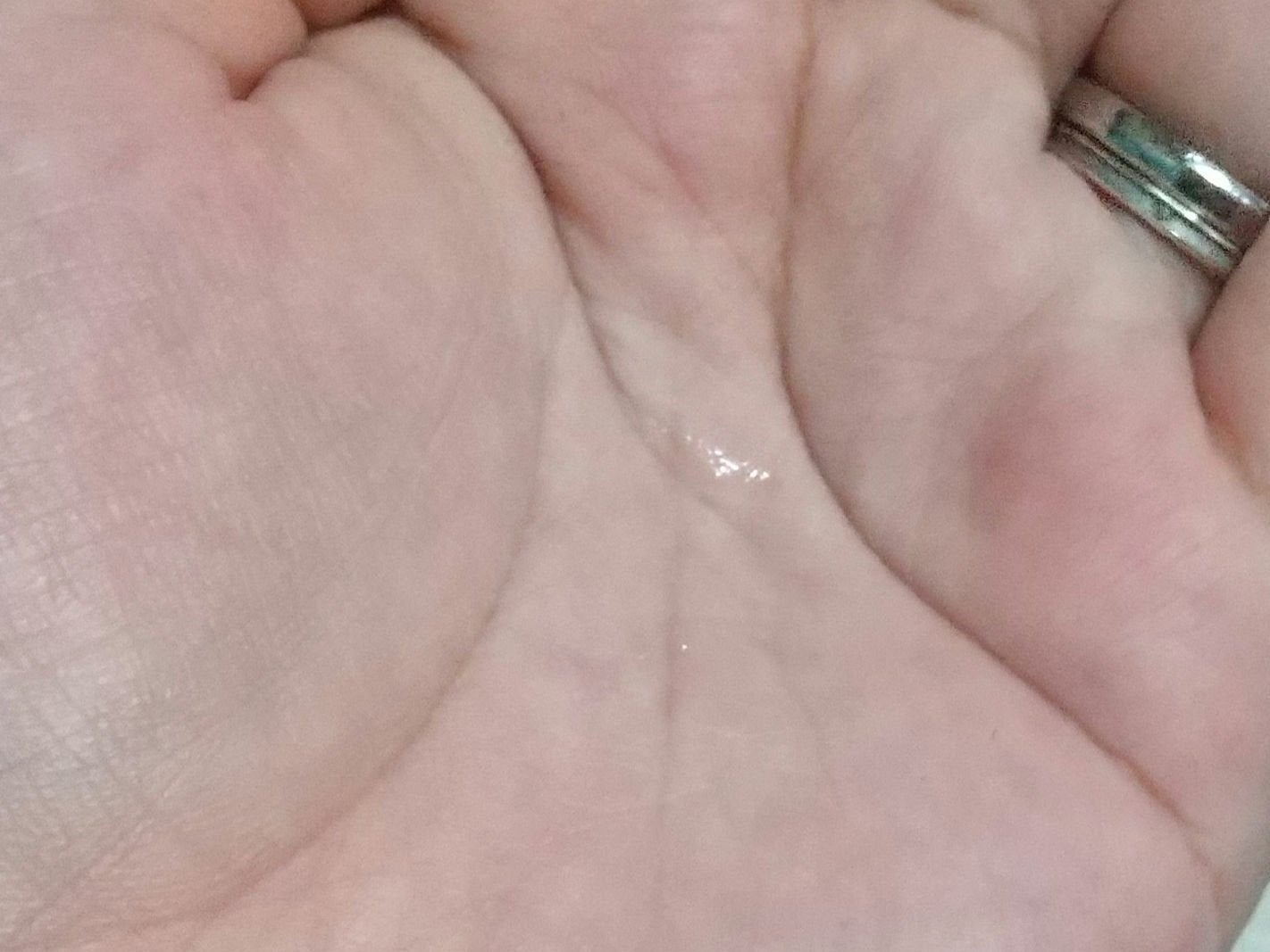 TXトーニングエッセンス2000/VT/美容液を使ったクチコミ(3枚目)